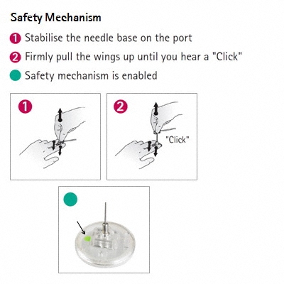 Safety Mechanism of the Surecan® Safety