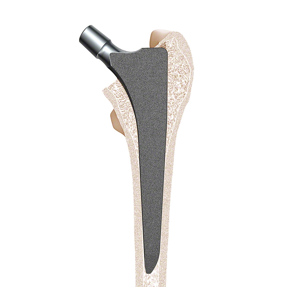 TRJ® Hip Stem